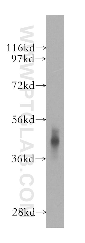 CSNK2A1 Antibody in Western Blot (WB)