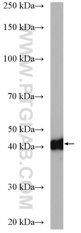 CSNK2A1 Antibody in Western Blot (WB)