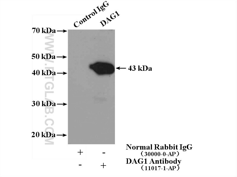Dystroglycan Antibody in Immunoprecipitation (IP)