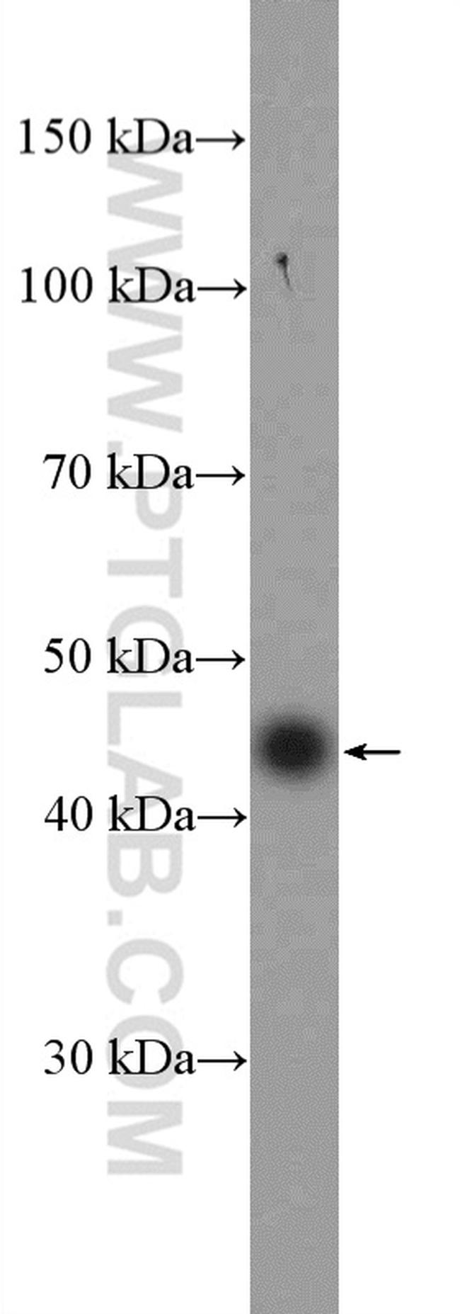 Dystroglycan Antibody in Western Blot (WB)