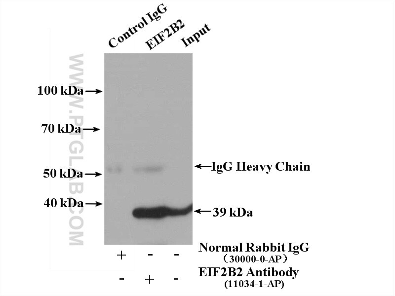 EIF2B2 Antibody in Immunoprecipitation (IP)