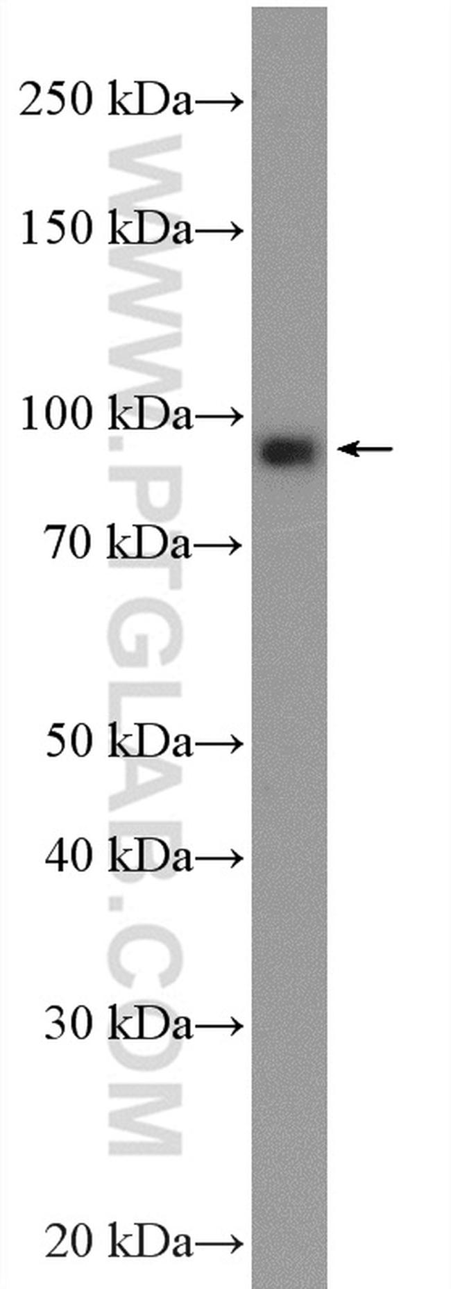 Oligophrenin 1 Antibody in Western Blot (WB)