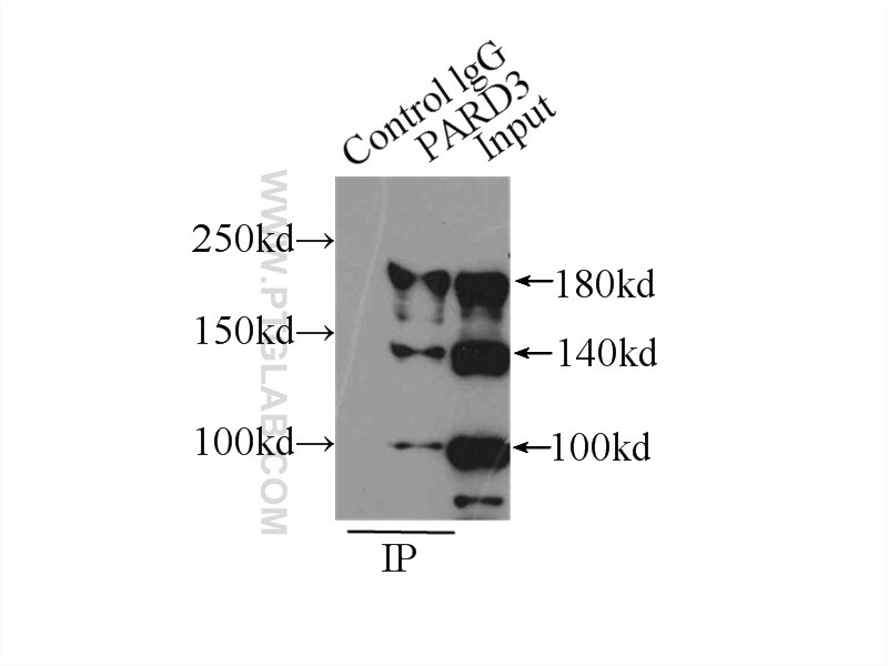 PARD3 Antibody in Immunoprecipitation (IP)