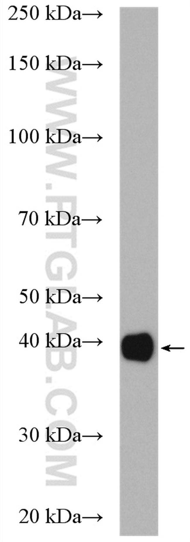 GNAI2 Antibody in Western Blot (WB)