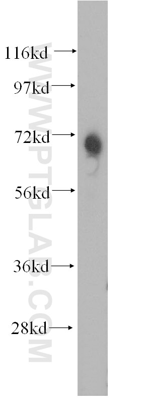 RHOT2 Antibody in Western Blot (WB)