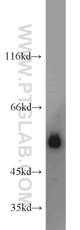 MUM1/IRF4 Antibody in Western Blot (WB)