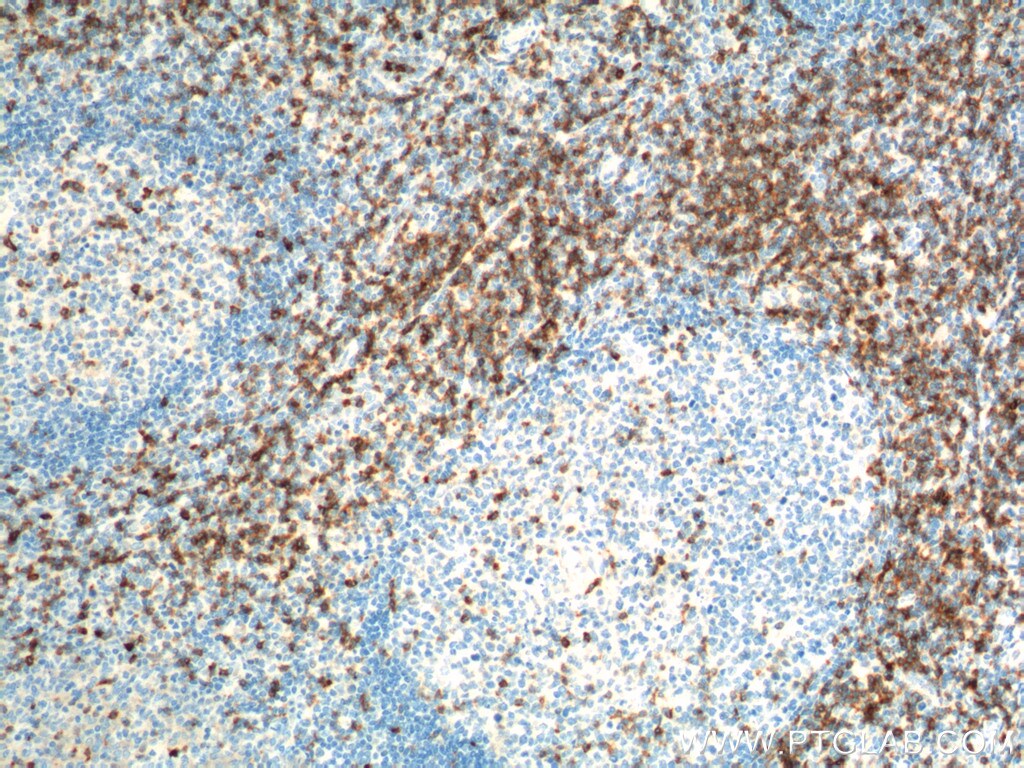 CD7 Antibody in Immunohistochemistry (Paraffin) (IHC (P))