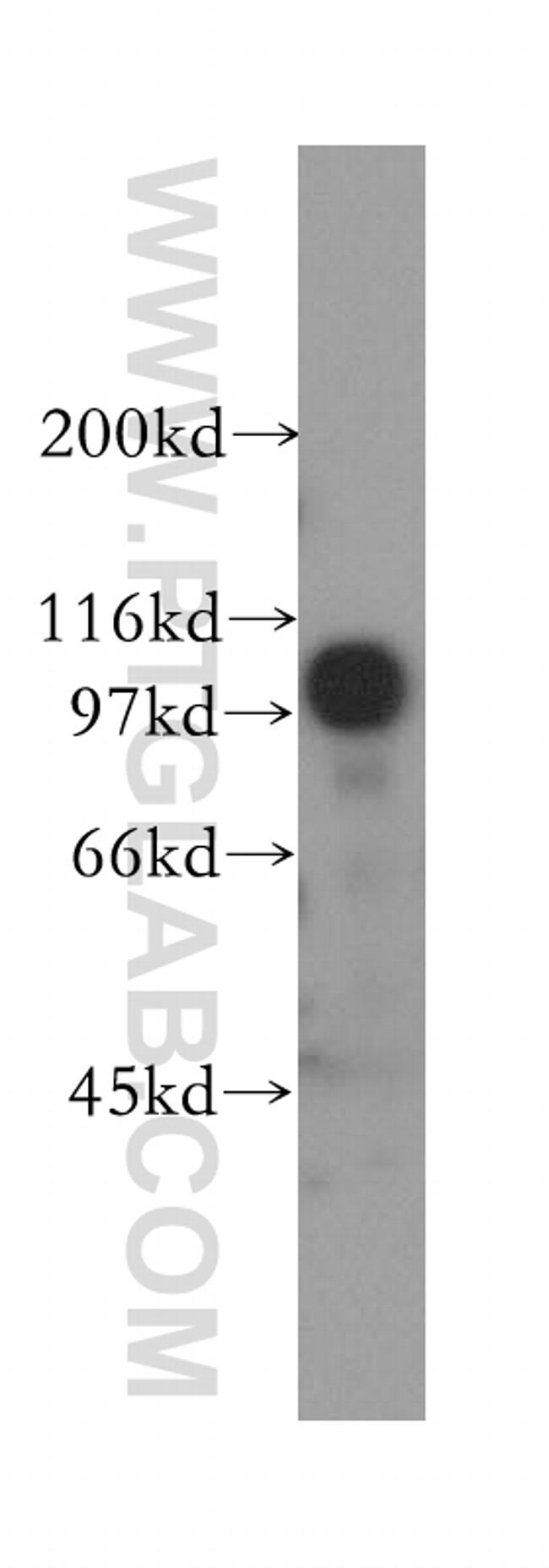 DDX20 Antibody in Western Blot (WB)