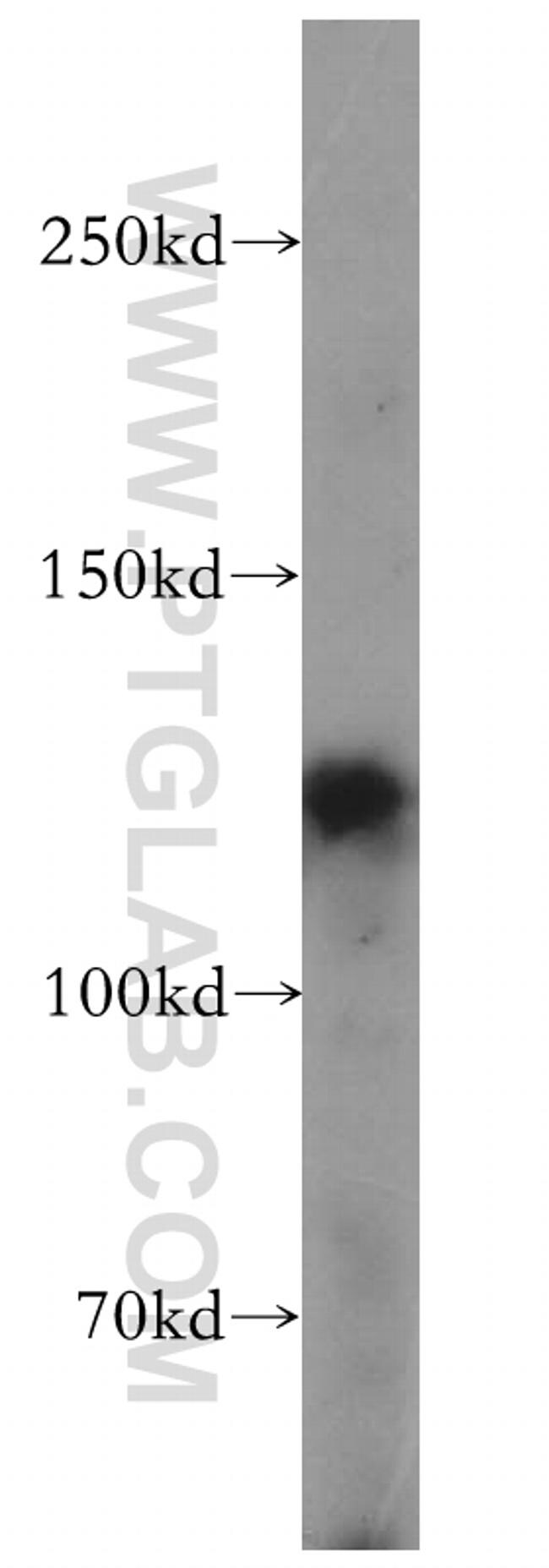 FBF1 Antibody in Western Blot (WB)