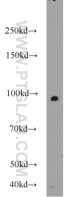 MALT1 Antibody in Western Blot (WB)