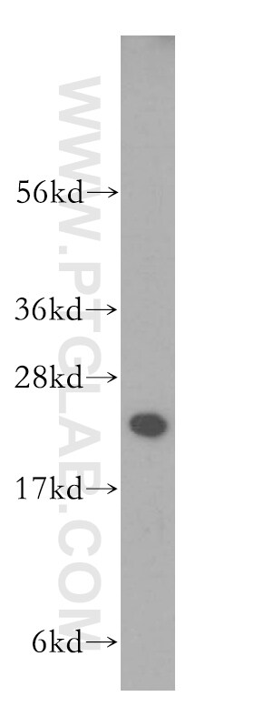 RAB1A Antibody in Western Blot (WB)