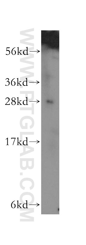 GAR1 Antibody in Western Blot (WB)