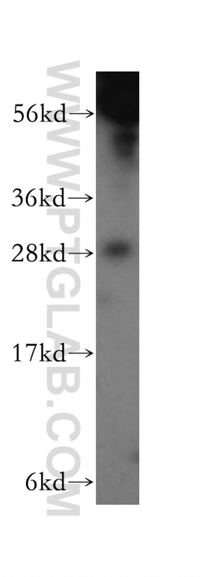 GAR1 Antibody in Western Blot (WB)