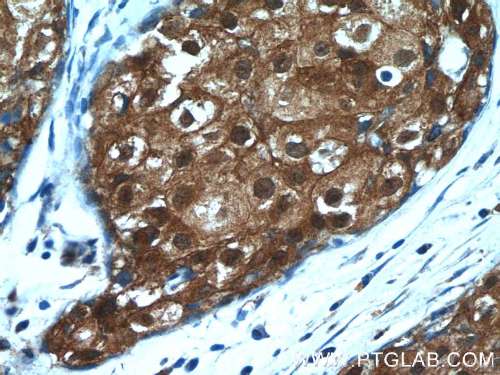 SRP54 Antibody (11729-1-AP)