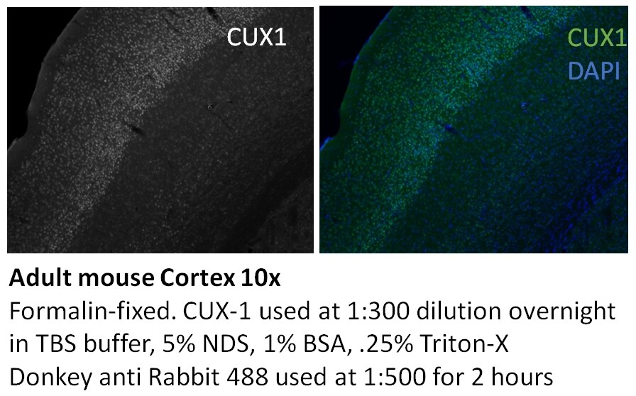 CUX1/Protein CASP Antibody in Immunohistochemistry (IHC)