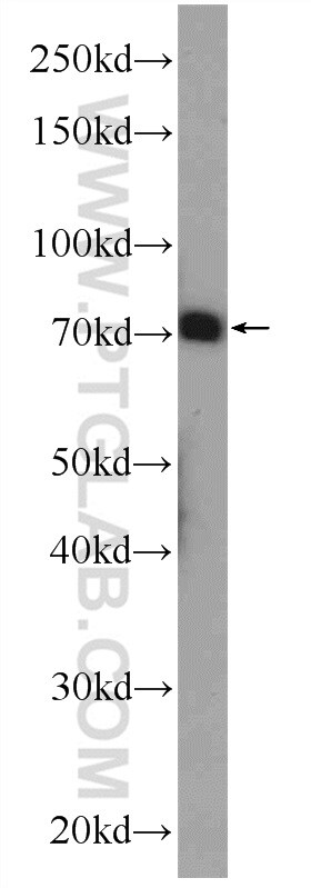CUX1/Protein CASP Antibody in Western Blot (WB)