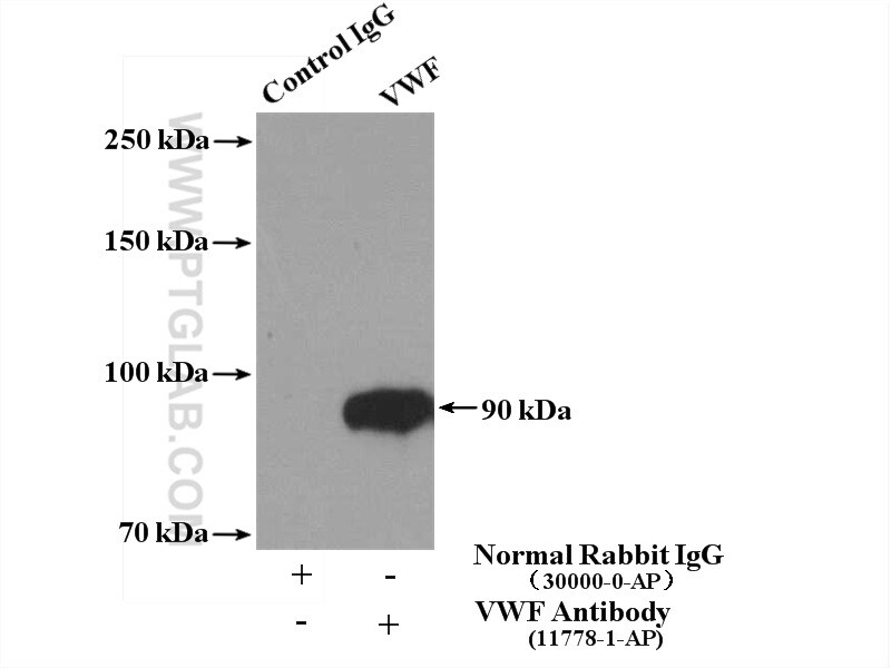 VWF/VWFpp Antibody in Immunoprecipitation (IP)