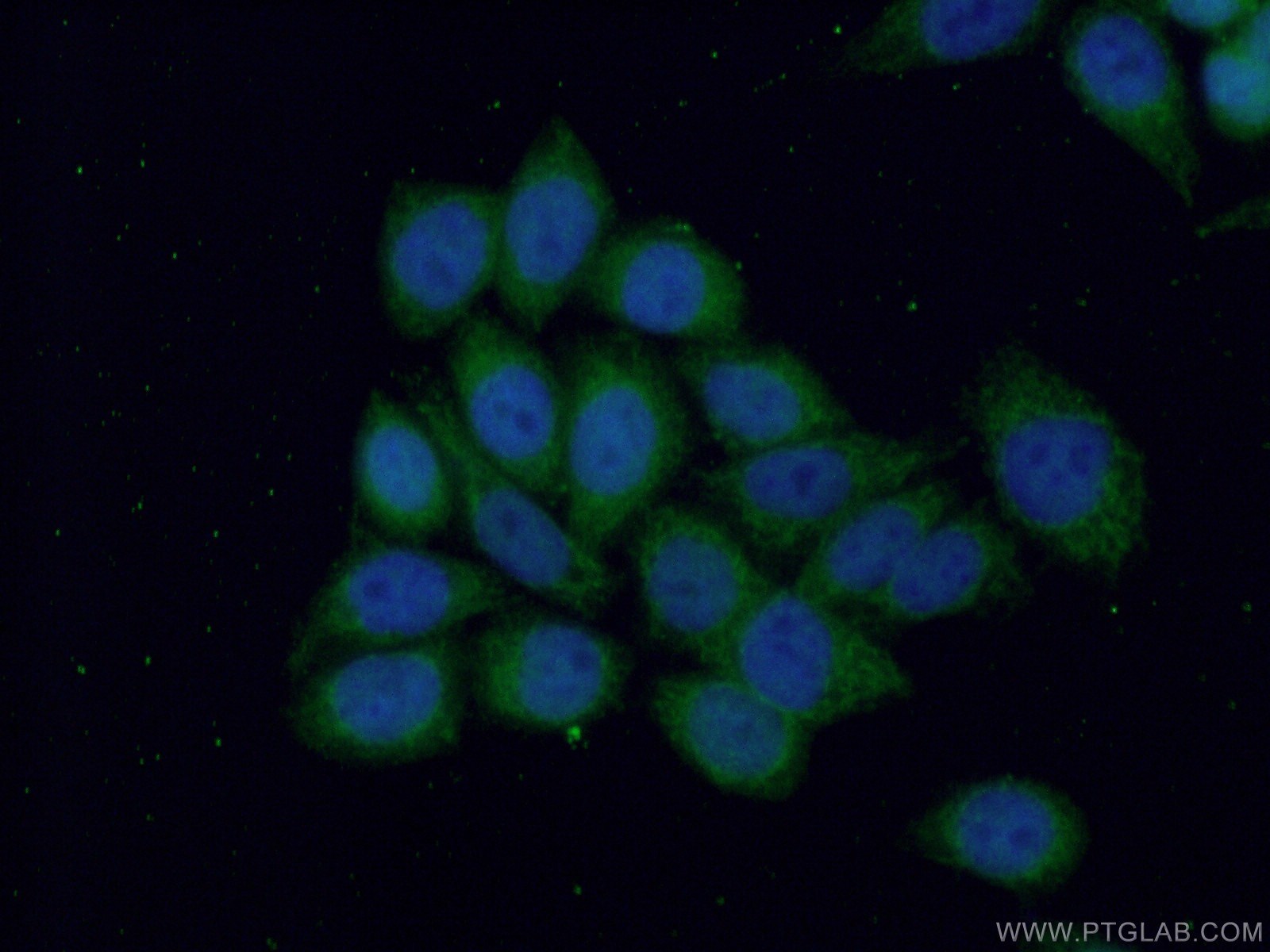ANKRD2 Antibody in Immunocytochemistry (ICC/IF)