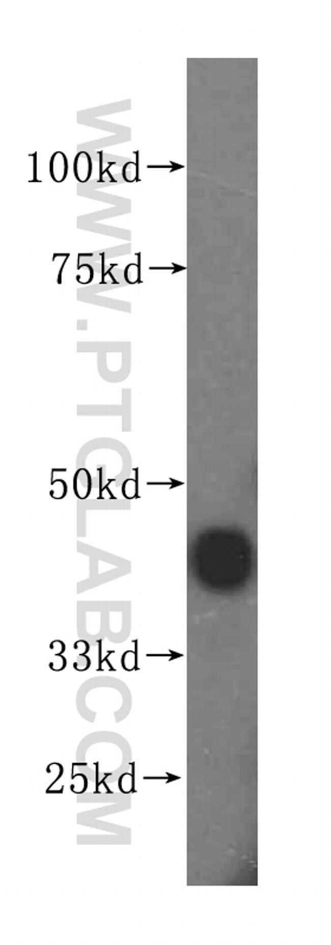 ANKRD2 Antibody in Western Blot (WB)