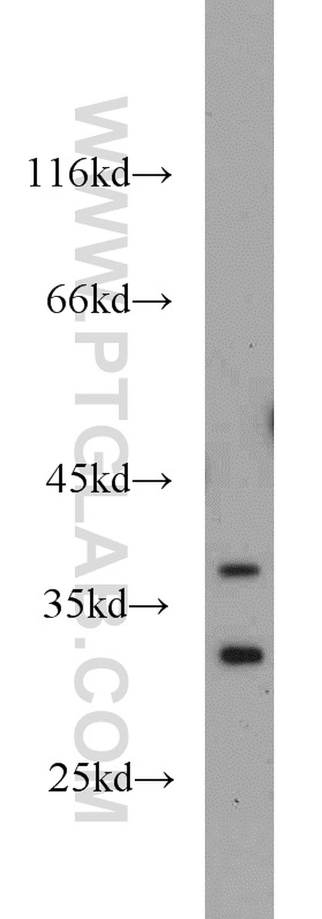 WBP2 Antibody in Western Blot (WB)