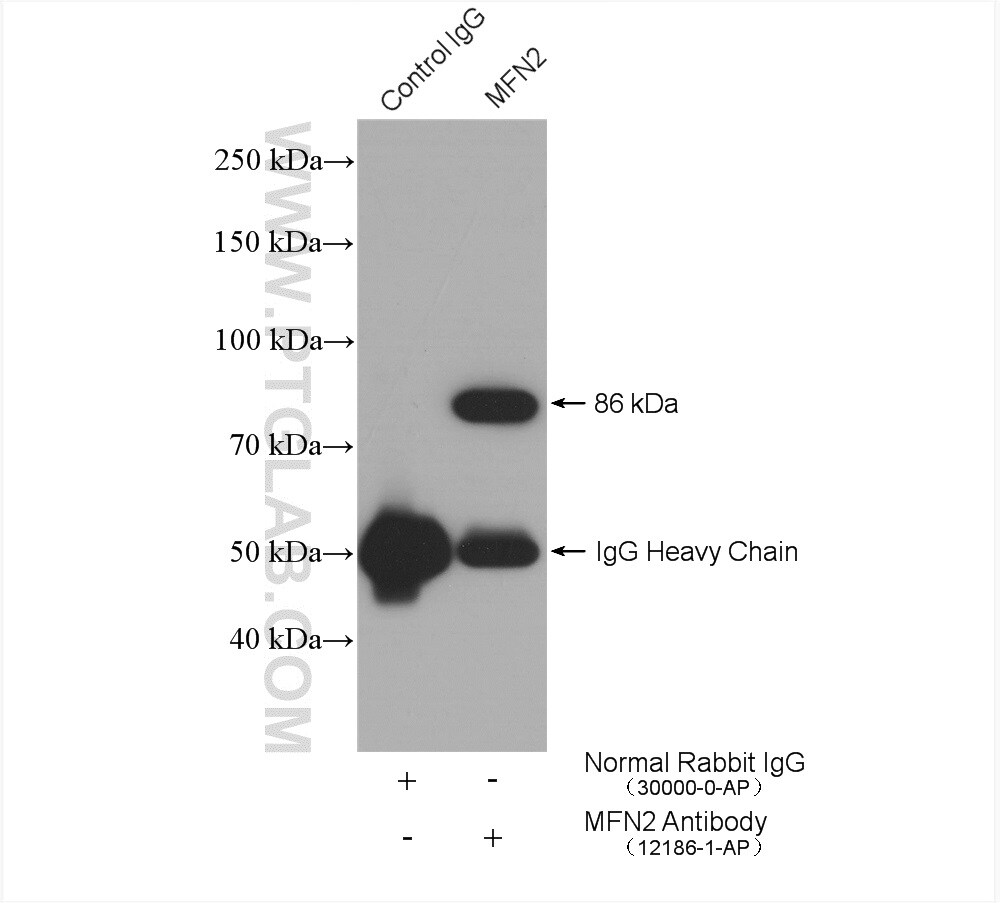 MFN2 Antibody in Immunoprecipitation (IP)