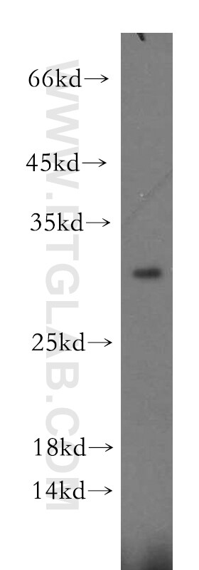 EIF4E2 Antibody in Western Blot (WB)