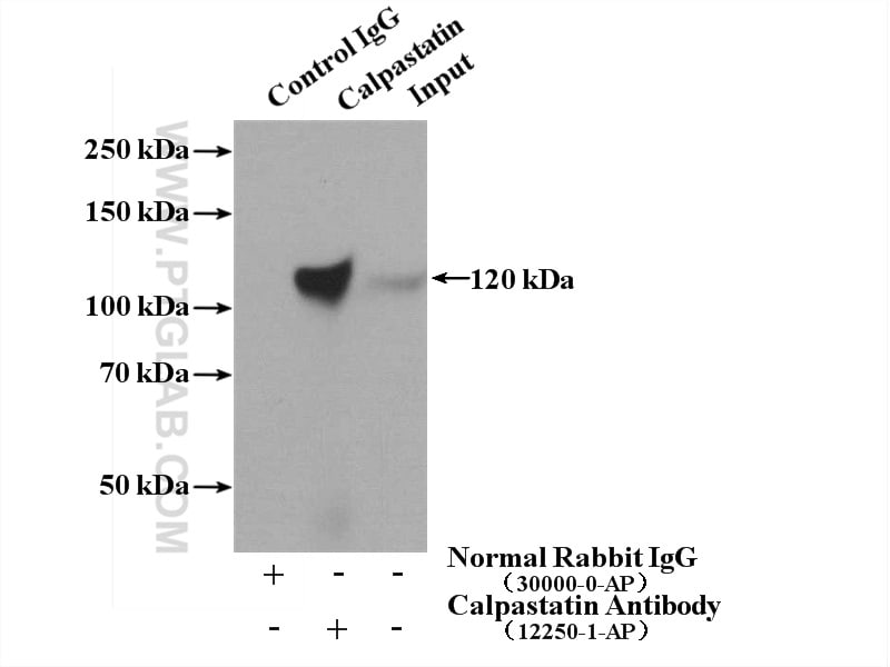 Calpastatin Antibody in Immunoprecipitation (IP)