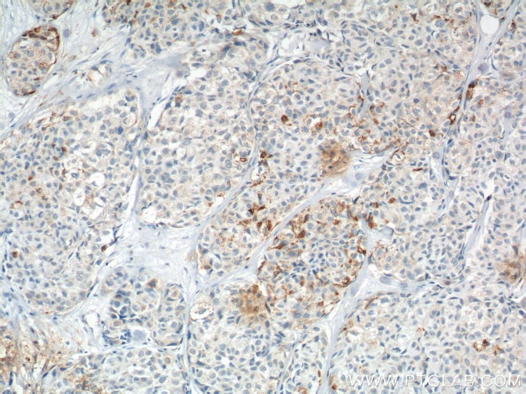 COX2 Antibody (12375-1-AP)