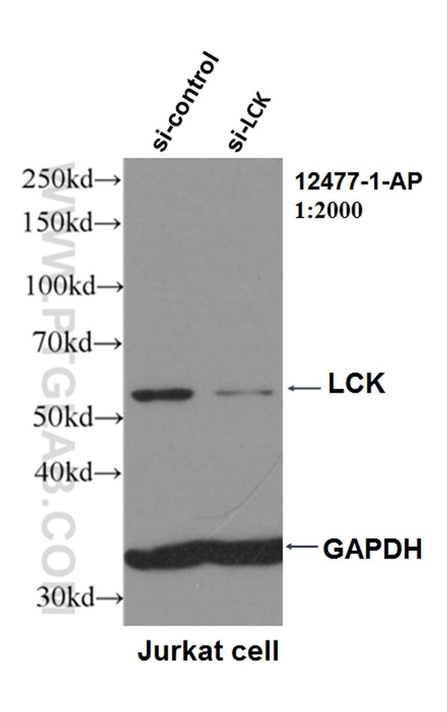 LCK Antibody (12477-1-AP)