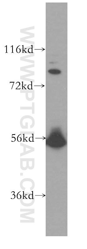 LCK Antibody (12477-1-AP)