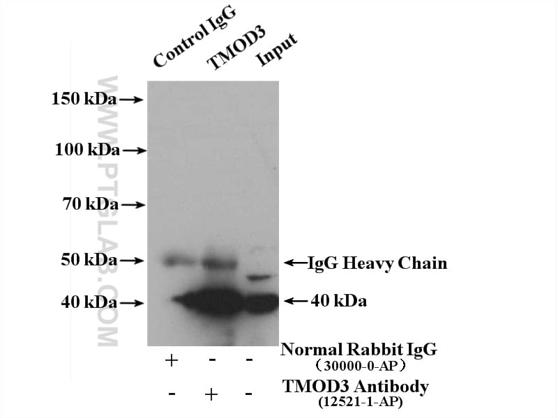 TMOD3 Antibody in Immunoprecipitation (IP)