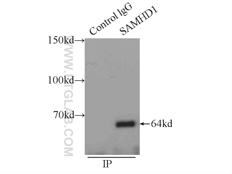 SAMHD1 Antibody in Immunoprecipitation (IP)