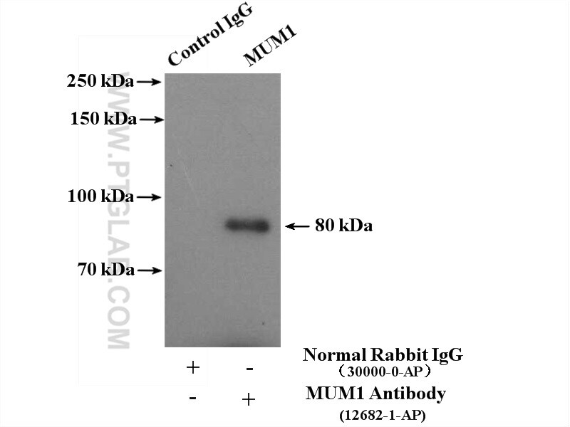 MUM1 Antibody in Immunoprecipitation (IP)