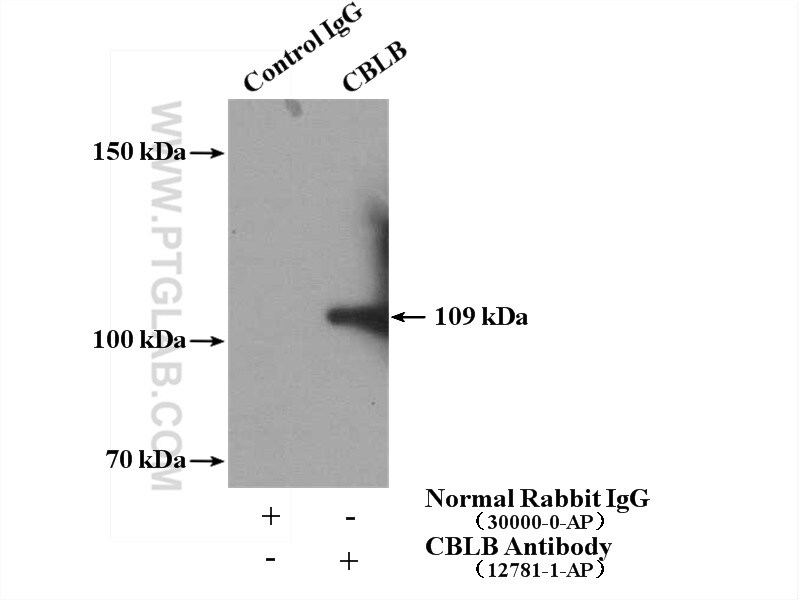 CBLB Antibody in Immunoprecipitation (IP)