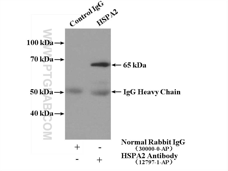 HSPA2 Antibody in Immunoprecipitation (IP)