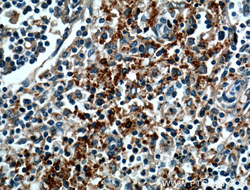 CD42b Antibody in Immunohistochemistry (Paraffin) (IHC (P))