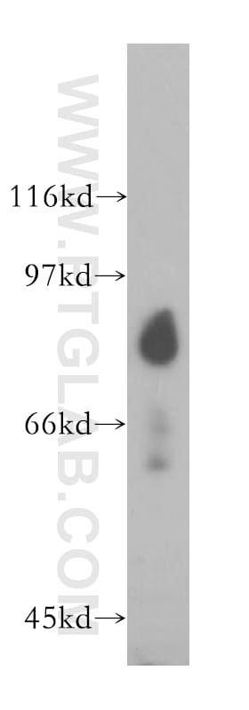 SH2D3C Antibody in Western Blot (WB)