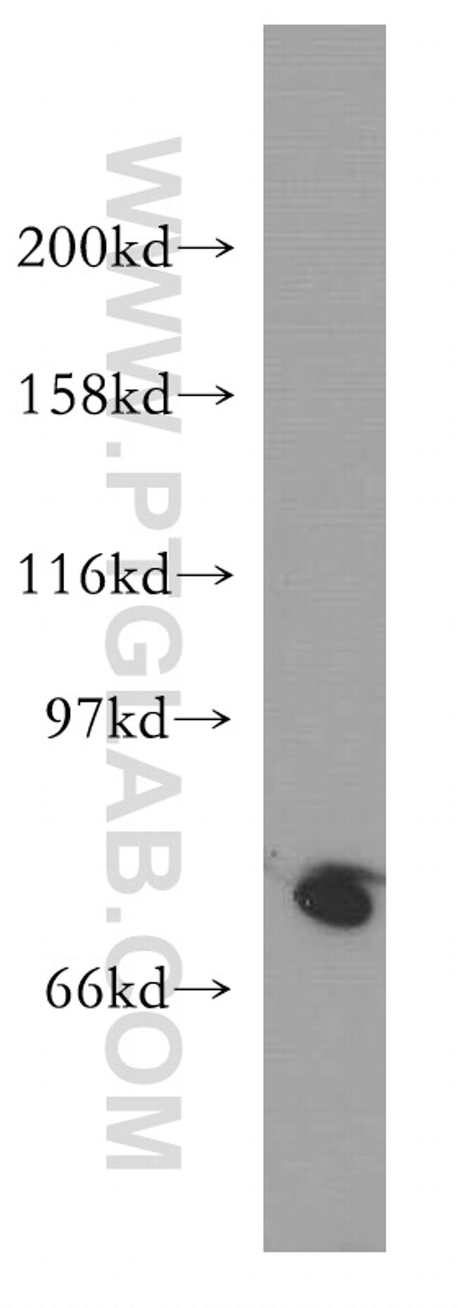SH2D3C Antibody in Western Blot (WB)