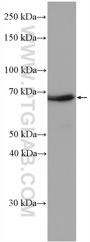 NF-L Antibody (12998-1-AP)