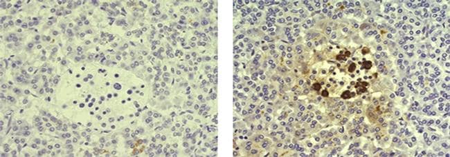 Mouse IgG (H+L) Secondary Antibody in Immunohistochemistry (Paraffin) (IHC (P))