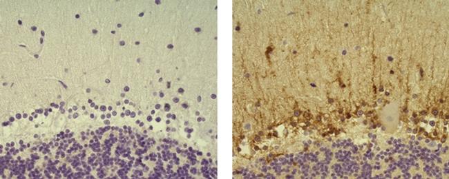 Mouse IgG2b kappa Isotype Control in Immunohistochemistry (Paraffin) (IHC (P))