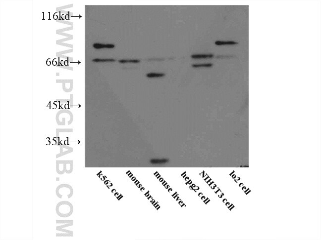 STAM2 Antibody in Western Blot (WB)
