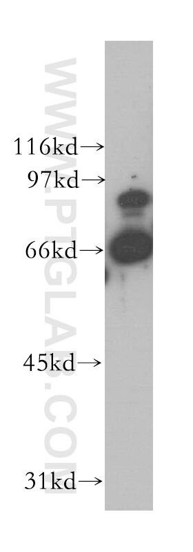 STAM2 Antibody in Western Blot (WB)