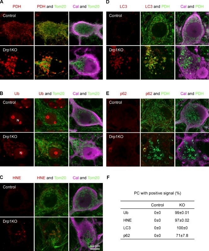 Ubiquitin Antibody (Monoclonal, Ubi-1)