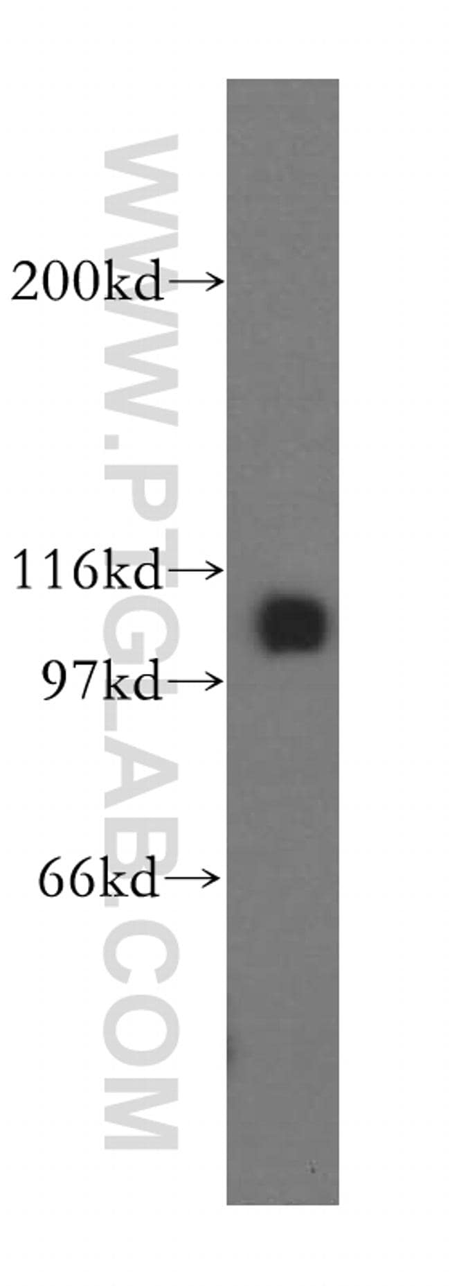 MCM6 Antibody in Western Blot (WB)