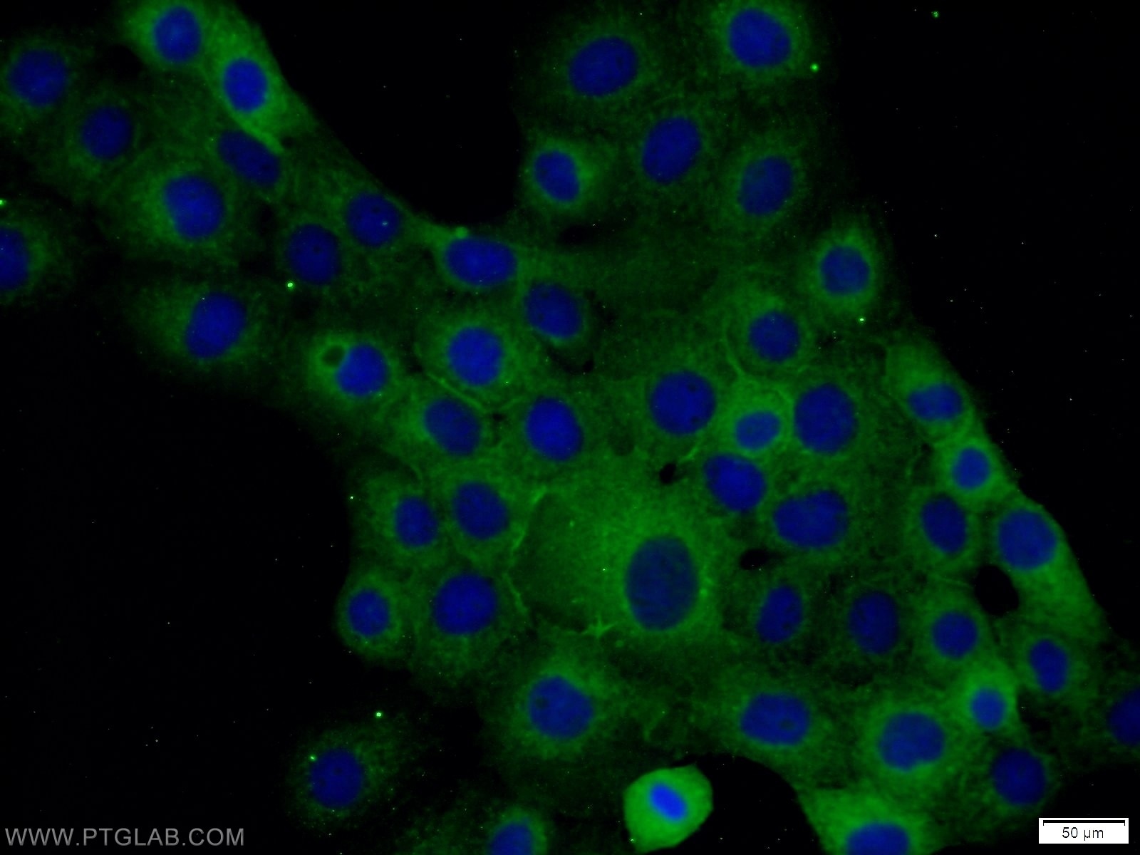 Anti-Occludin Antibodies | Invitrogen