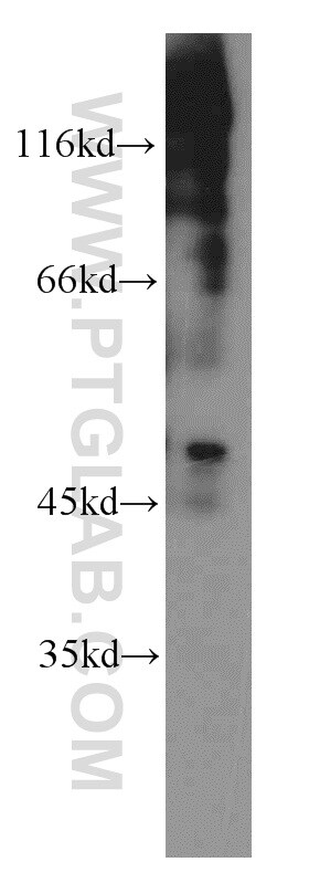 EGR2 Antibody in Western Blot (WB)