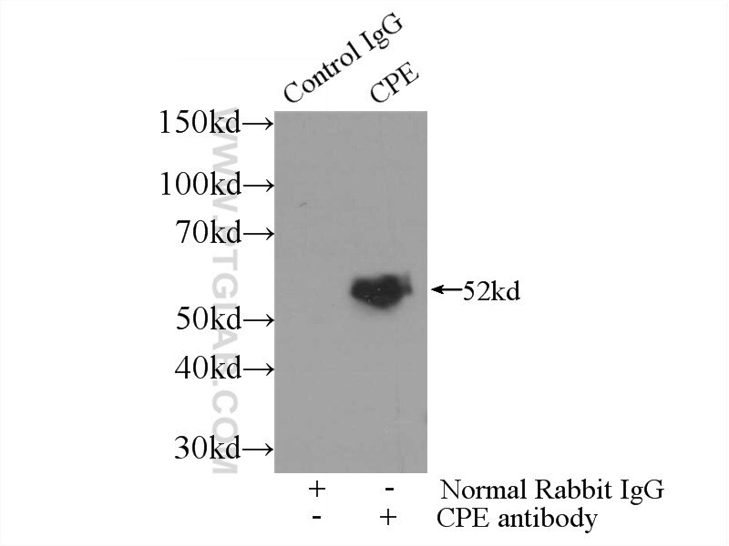 Carboxypeptidase E Antibody in Immunoprecipitation (IP)