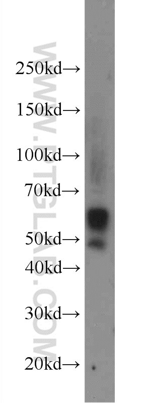 Carboxypeptidase E Antibody in Western Blot (WB)