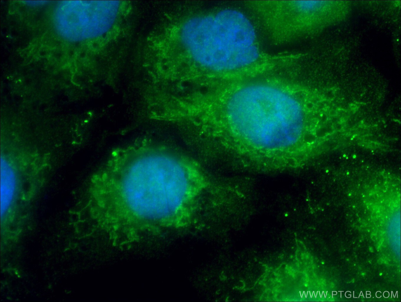 MX1 Antibody in Immunocytochemistry (ICC/IF)